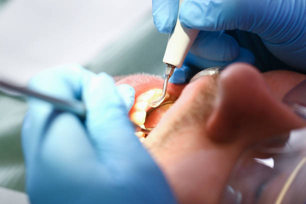 Best Emergency Gum Treatment in Spout Springs, NC
